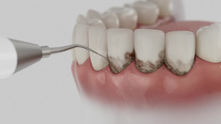 Reliable Wisdom Tooth Removal contractor in Collier County County, FL by Dentist Open Now